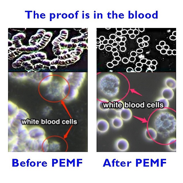 PEMF BLOOD RESULTS